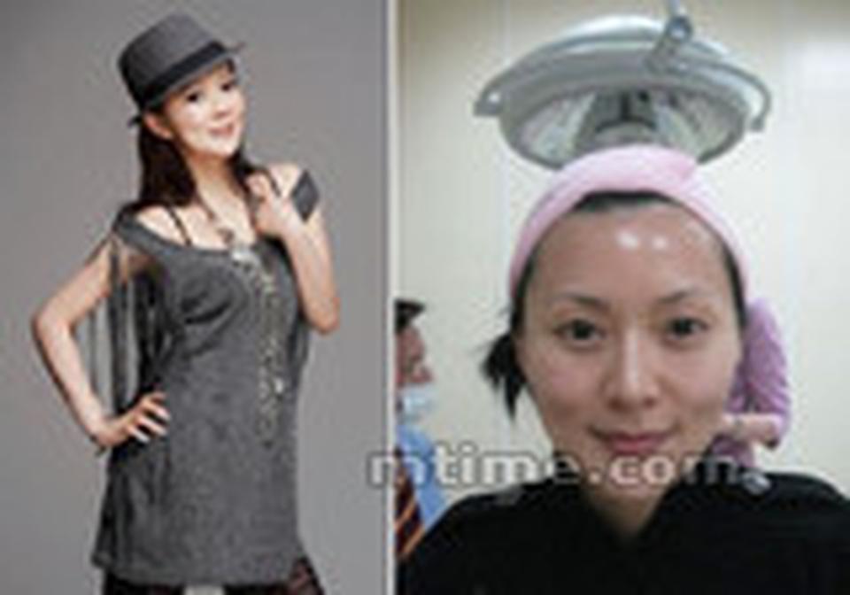 现年40岁的落选港姐陈莉敏从不否认整容的事实，并承认曾前后整容高达30次。近日她做出回应，称自己是“医美前线的勇女”，自己的脸“也许有点假，但心比毒舌族真”。还大方把整形的心得在博客和视频网站上分享。