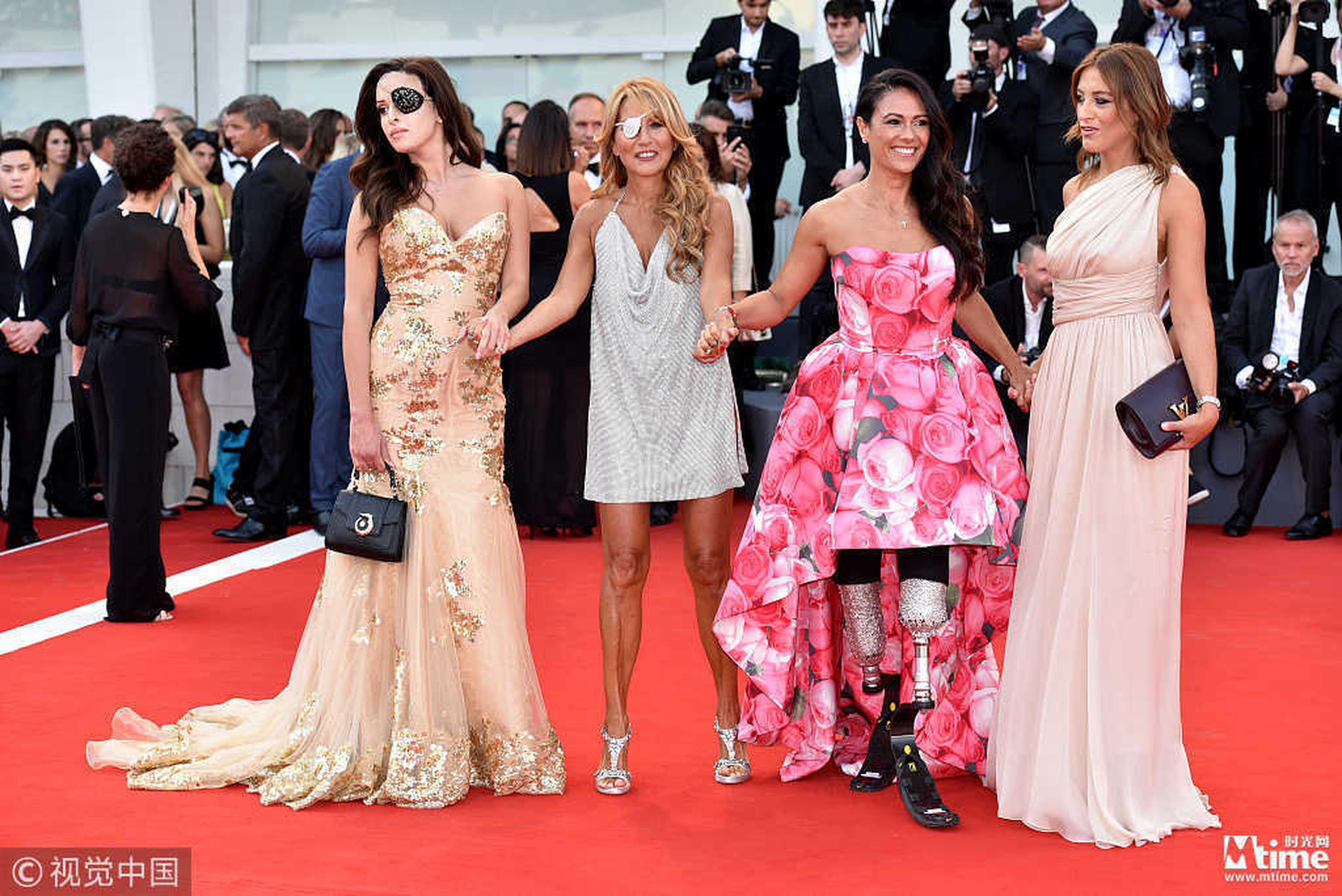 残奥会运动员Giusy Versace(右二)、曾被前男友泼硫酸的意大利前选美小姐Gessica Notaro(左一) 等女性亮相红毯