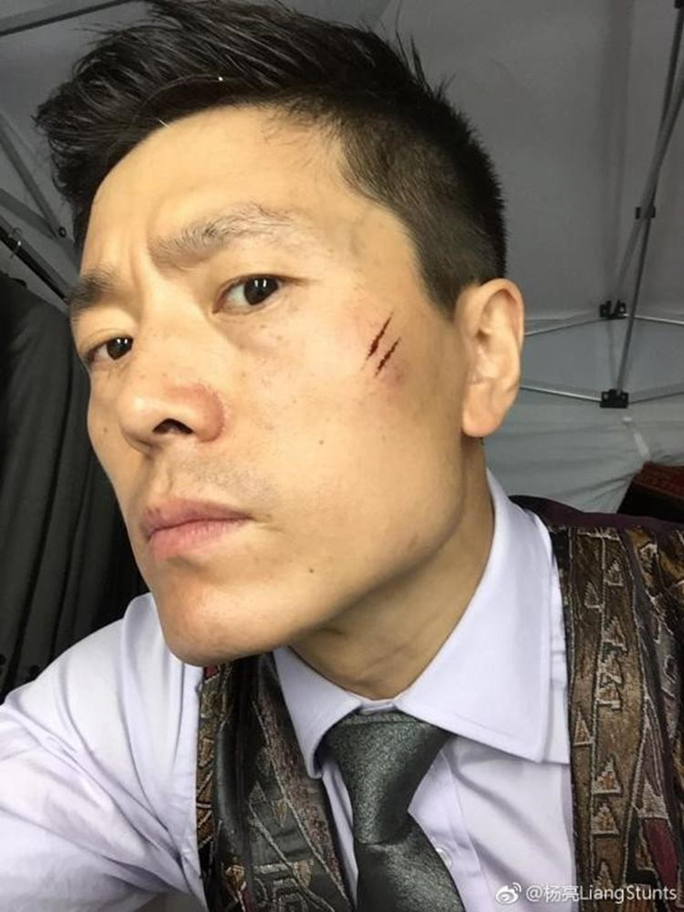 “厕所大战”拍摄受伤